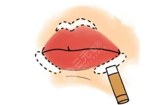馒头型是不是弄多了才形成的?