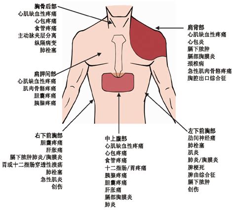 肺癌背疼位置图，上背部疼放射至