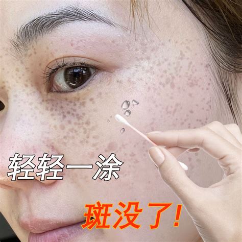 祛斑原液 它的正确使用方法