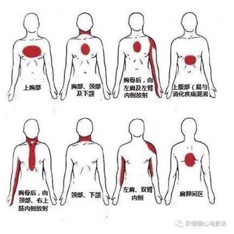 人体器官后背疼痛对应器官图,9处致命的心脏疼痛位置图