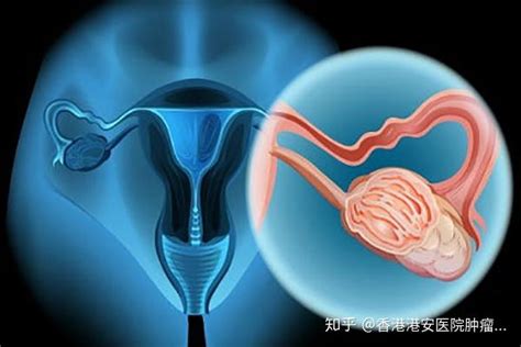 真人早期宫颈癌的分泌物图片症状