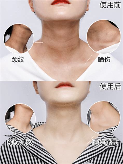 脖子怎么美白